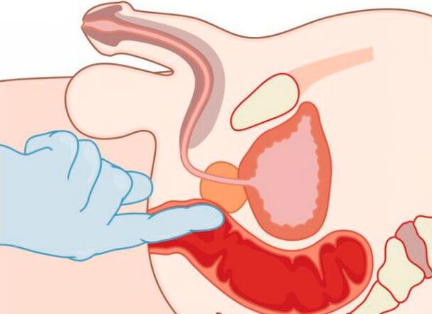Erkaklarning anal orgazmi